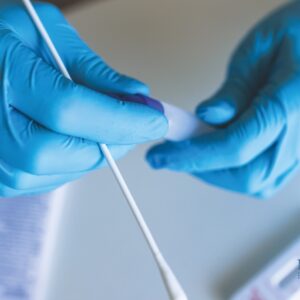 INTRODUCING PCR TESTING AT NCFMG